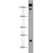 SPIN2B Rabbit Polyclonal Antibody (10107-2-AP)