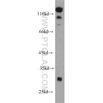 SPIN2B Rabbit Polyclonal Antibody (10107-2-AP)