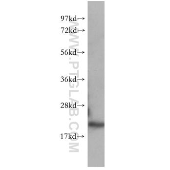 CDC42 Rabbit Polyclonal Antibody (10155-1-AP)