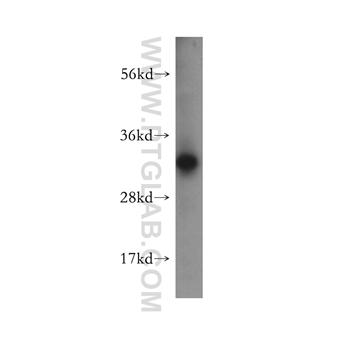 CHMP2A Rabbit Polyclonal Antibody (10477-1-AP)