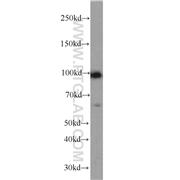 PPP1R15A Rabbit Polyclonal Antibody (10449-1-AP)
