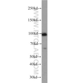 PPP1R15A Rabbit Polyclonal Antibody (10449-1-AP)