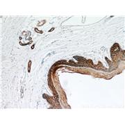 S100A14 Rabbit Polyclonal Antibody (10489-1-AP)