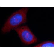 MOV10 Rabbit Polyclonal Antibody (10370-1-AP)