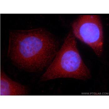 CIRBP Rabbit Polyclonal Antibody (10209-2-AP)