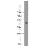 MAD2L1 Rabbit Polyclonal Antibody (10337-1-AP)