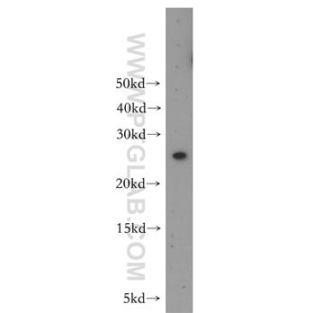 MAD2L1 Rabbit Polyclonal Antibody (10337-1-AP)