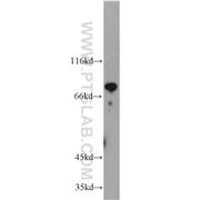 HBS1L Rabbit Polyclonal Antibody (10359-1-AP)