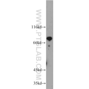 HBS1L Rabbit Polyclonal Antibody (10359-1-AP)