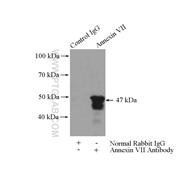 ANXA7 Rabbit Polyclonal Antibody (10154-2-AP)