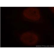 NUDT21 Rabbit Polyclonal Antibody (10322-1-AP)