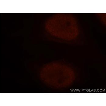 NUDT21 Rabbit Polyclonal Antibody (10322-1-AP)