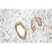 RABAC1 Rabbit Polyclonal Antibody (10542-1-AP)