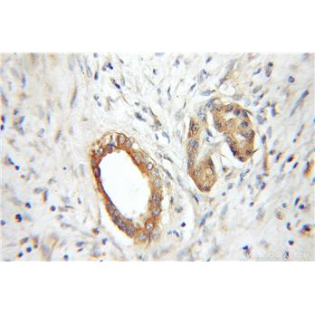 RABAC1 Rabbit Polyclonal Antibody (10542-1-AP)