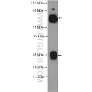 Human IgG Rabbit Polyclonal Antibody (10284-1-AP)