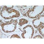 BIRC2 Rabbit Polyclonal Antibody (10022-1-AP)
