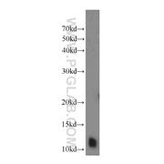 DNAL4 Rabbit Polyclonal Antibody (10388-1-AP)