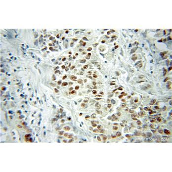 VGLL1 Rabbit Polyclonal Antibody (10124-2-AP)