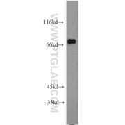 GGA2 Rabbit Polyclonal Antibody (10356-1-AP)