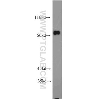 GGA2 Rabbit Polyclonal Antibody (10356-1-AP)