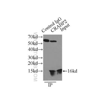 CRABP2 Rabbit Polyclonal Antibody (10225-1-AP)