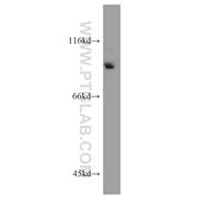 BAP1 Rabbit Polyclonal Antibody (10398-1-AP)