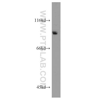BAP1 Rabbit Polyclonal Antibody (10398-1-AP)