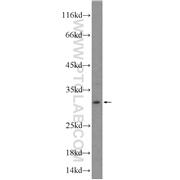 HTATIP2 Rabbit Polyclonal Antibody (10251-1-AP)