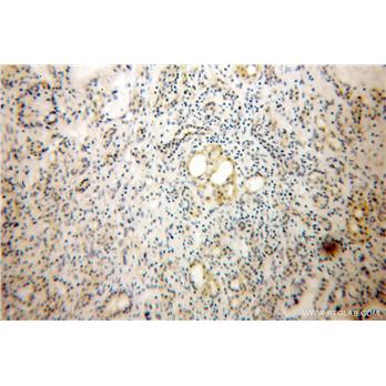 DPT Rabbit Polyclonal Antibody (10537-1-AP)