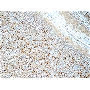 SNRPA Rabbit Polyclonal Antibody (10212-1-AP)