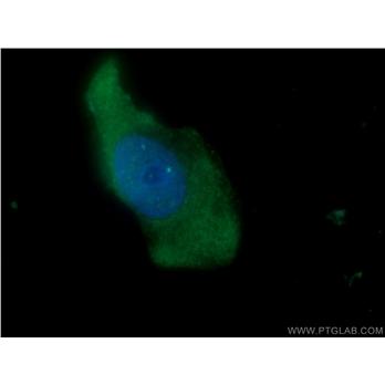 NKIRAS2 Rabbit Polyclonal Antibody (10174-1-AP)