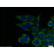 ECD Rabbit Polyclonal Antibody (10192-1-AP)