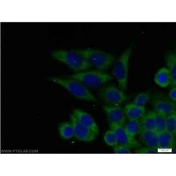 ECD Rabbit Polyclonal Antibody (10192-1-AP)