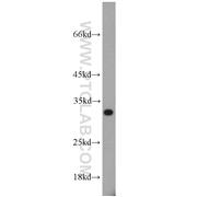 PSME1 Rabbit Polyclonal Antibody (10543-1-AP)