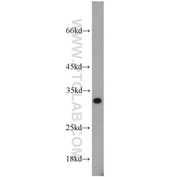 PSME1 Rabbit Polyclonal Antibody (10543-1-AP)