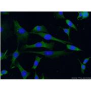 RAB4A Rabbit Polyclonal Antibody (10347-1-AP)