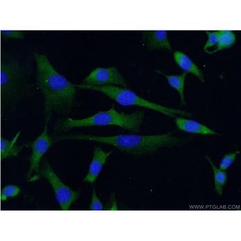 RAB4A Rabbit Polyclonal Antibody (10347-1-AP)