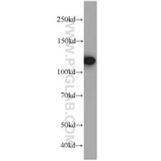 EFTUD2 Rabbit Polyclonal Antibody (10208-1-AP)
