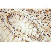 DDX21 Rabbit Polyclonal Antibody (10528-1-AP)