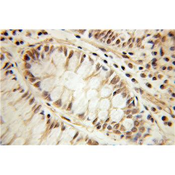 DDX21 Rabbit Polyclonal Antibody (10528-1-AP)