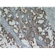 CEACAM5 Rabbit Polyclonal Antibody (10421-1-AP)
