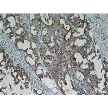 CEACAM5 Rabbit Polyclonal Antibody (10421-1-AP)