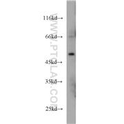 MKNK1 Rabbit Polyclonal Antibody (10136-1-AP)