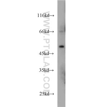 MKNK1 Rabbit Polyclonal Antibody (10136-1-AP)