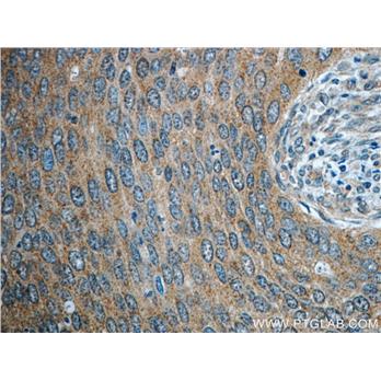 STAT3 Rabbit Polyclonal Antibody (10253-2-AP)