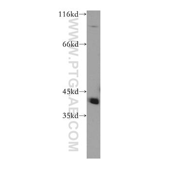 RABEPK Rabbit Polyclonal Antibody (10213-2-AP)