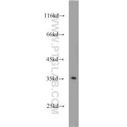 SDCBP2 Rabbit Polyclonal Antibody (10407-1-AP)
