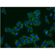 TAGLN2 Rabbit Polyclonal Antibody (10234-2-AP)
