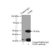 NOB1 Rabbit Polyclonal Antibody (10091-2-AP)