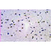 RPA2 Rabbit Polyclonal Antibody (10412-1-Ap)